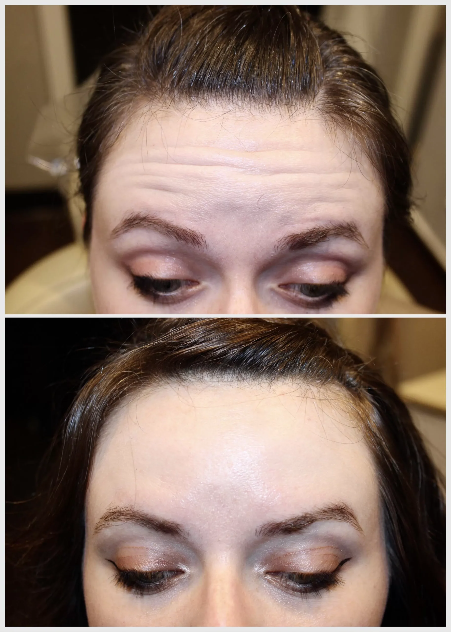 Before and After