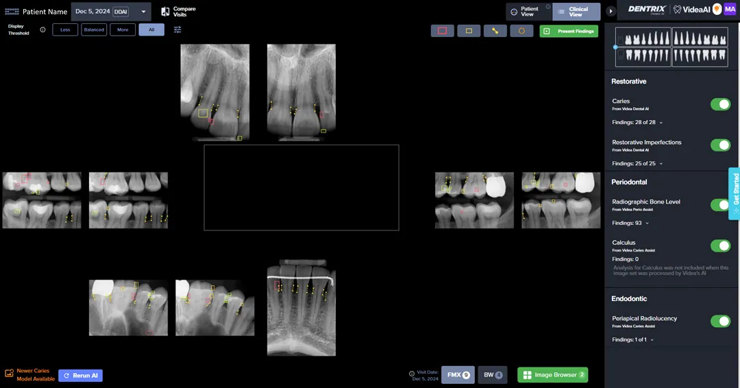Dentrix AI Screen